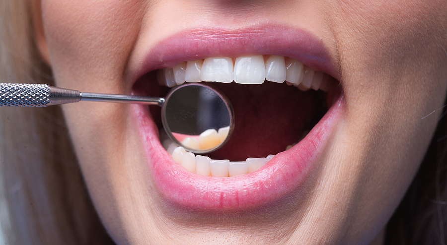 The Comprehensive Health Benefits of Investing in Cosmetic Dentistry