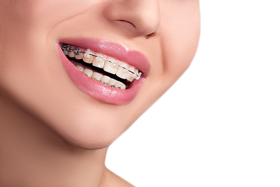 We fabricate crowns in-house!
